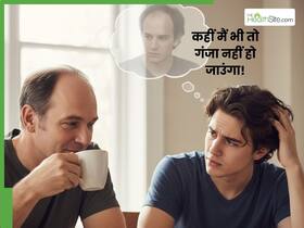 क्या आपकी फैमिली हिस्ट्री में भी गंजापन है? आज की यंग जनरेशन इससे कैसे बच सकती है?