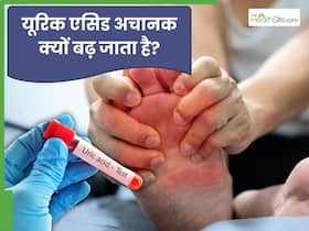 यूरिक एसिड अचानक क्यों बढ़ जाता है? High Uric Acid से जुड़े 5 सवाल-जवाब