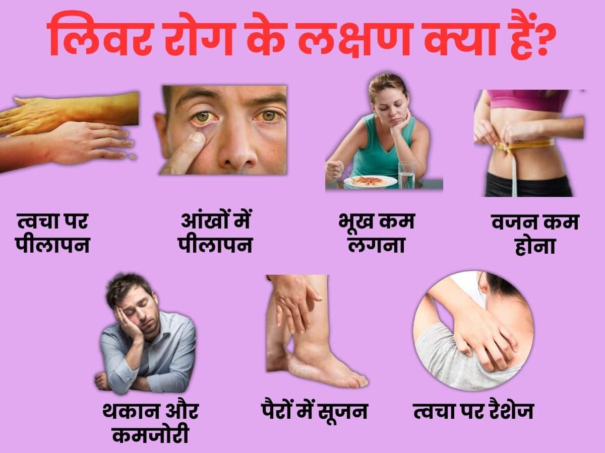 liver disease symptoms