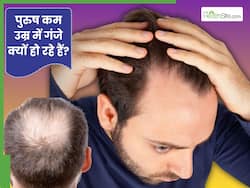पुरुष कम उम्र में गंजे क्यों हो रहे हैं लोग? क्या गंजेपन को रोका जा सकता है?