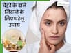 सर्दियों में चेहरे के दाने मिटाने के लिए घरेलू उपाय, 5वां है बेहद असरदार