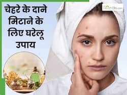 सर्दियों में चेहरे के दाने मिटाने के लिए घरेलू उपाय, 5वां हैं बेहद असरदार