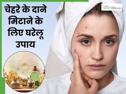 सर्दियों में चेहरे के दाने मिटाने के लिए घरेलू उपाय, 5वां है बेहद असरदार