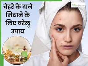 सर्दियों में चेहरे के दाने मिटाने के लिए घरेलू उपाय, 5वां हैं बेहद असरदार सर्दियों में चेहरे के दाने मिटाने के लिए घरेलू उपाय, 5वां हैं बेहद असरदार