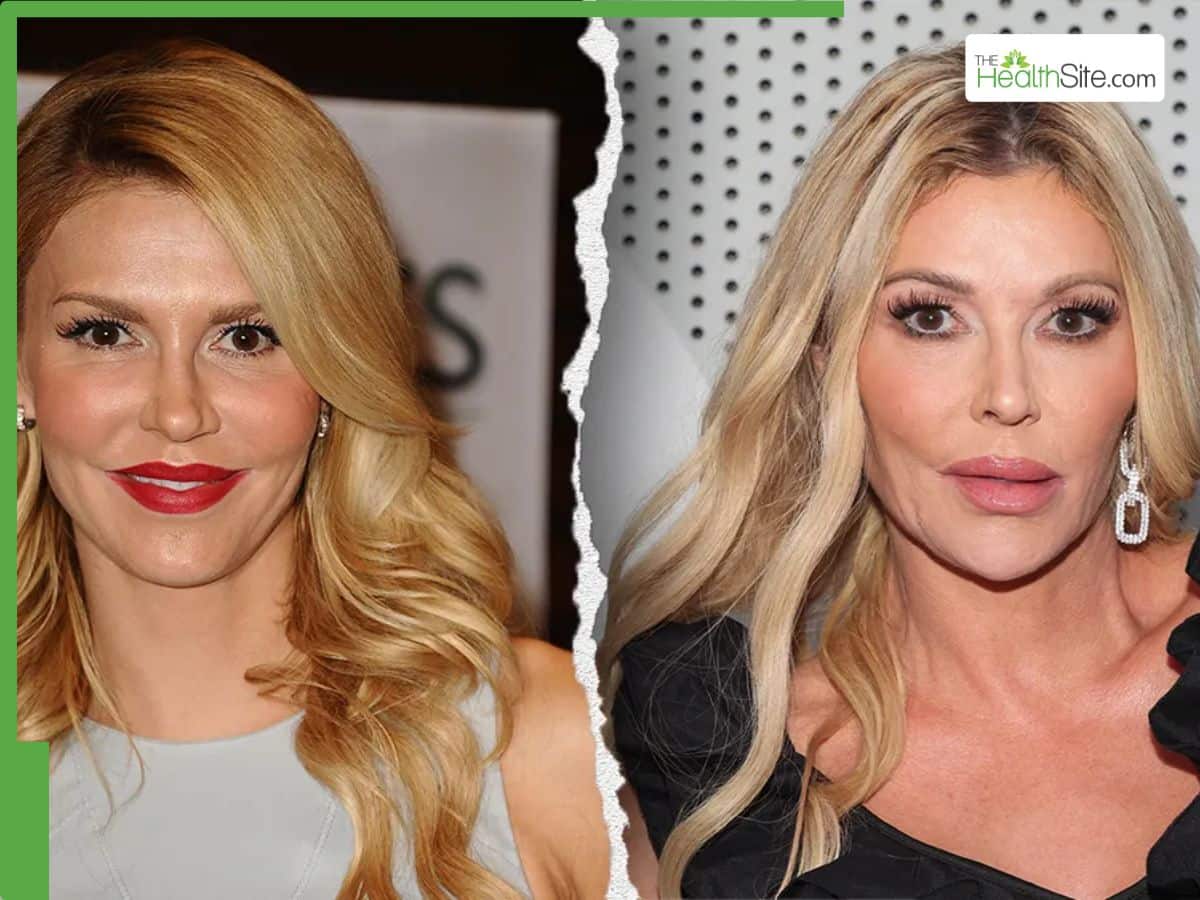 Brandi Glanville Shares Rare Health Update After Claiming Parasite Disfigured Her Face: What We Know So Far
