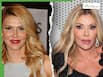 Brandi Glanville Shares Rare Health Update After Claiming Parasite Disfigured Her Face: What We Know So Far