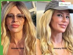 Brandi Glanville Steps Out With A New Look Before Sundance: Understanding Cosmetic Surgery And Its Risks