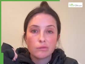 Bristol Palin Health Update: American Public Speaker Opens Up On Facial Paralysis Battle, Admits    Not Looking Great