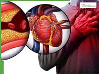 Heart Disease In India: Cardiologist Lists 4 Daily Habits That Increase Cardiovascular Disease Risk