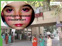 Chandigarh Sees Spike In Kawasaki Disease: Ignoring Long-Lasting Fever In Children Can Be Dangerous For The Heart
