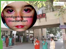 Chandigarh Sees Spike In Kawasaki Disease: Ignoring Long-Lasting Fever In Children Can Be Dangerous For The Heart Chandigarh Sees Spike In Kawasaki Disease: Ignoring Long-Lasting Fever In Children Can Be Dangerous For The Heart