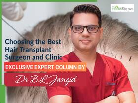 Choosing the Best Hair Transplant Surgeon and Clinic: 6 Expert Tips You Must Know Choosing the Best Hair Transplant Surgeon and Clinic: 6 Expert Tips You Must Know