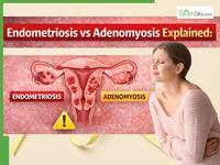 Endometriosis Vs Adenomyosis: 1 In 10 Women In India Silently Suffer From Uterine Conditions - Why Persistent Pain Shouldn't Be Ignored