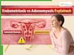 Endometriosis Vs Adenomyosis: 1 In 10 Women In India Silently Suffer From Uterine Conditions - Why Persistent Pain Shouldn't Be Ignored