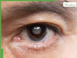 Glaucoma Awareness Month 2026: Did Your Parents Have Kala Motia? Your Risk Of Vision Loss May Be 10 Times Higher