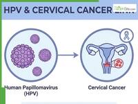 HPV And Cervical Cancer: Doctor Explains How The Virus Spreads And Why Vaccination, Screening Are Crucial