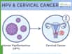 HPV And Cervical Cancer: Doctor Explains How The Virus Spreads And Why Vaccination, Screening Are Crucial