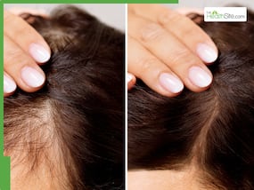Hair Fall In Winter:7 Shower Mistakes To Fix Right Now