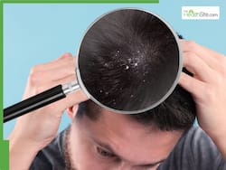 How To Reduce Hairfall In Winter: 6 Simple Lifestyle Tips For Healthy Hair Growth