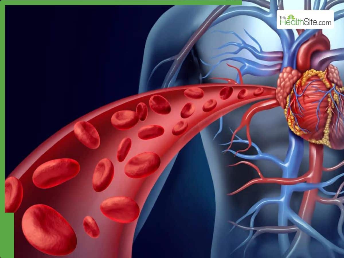 Diabetes and heart attack