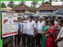 Kerala Hepatitis A Outbreak: Why A Preventable Disease Is Claiming So Many Lives? Know What Went Wrong