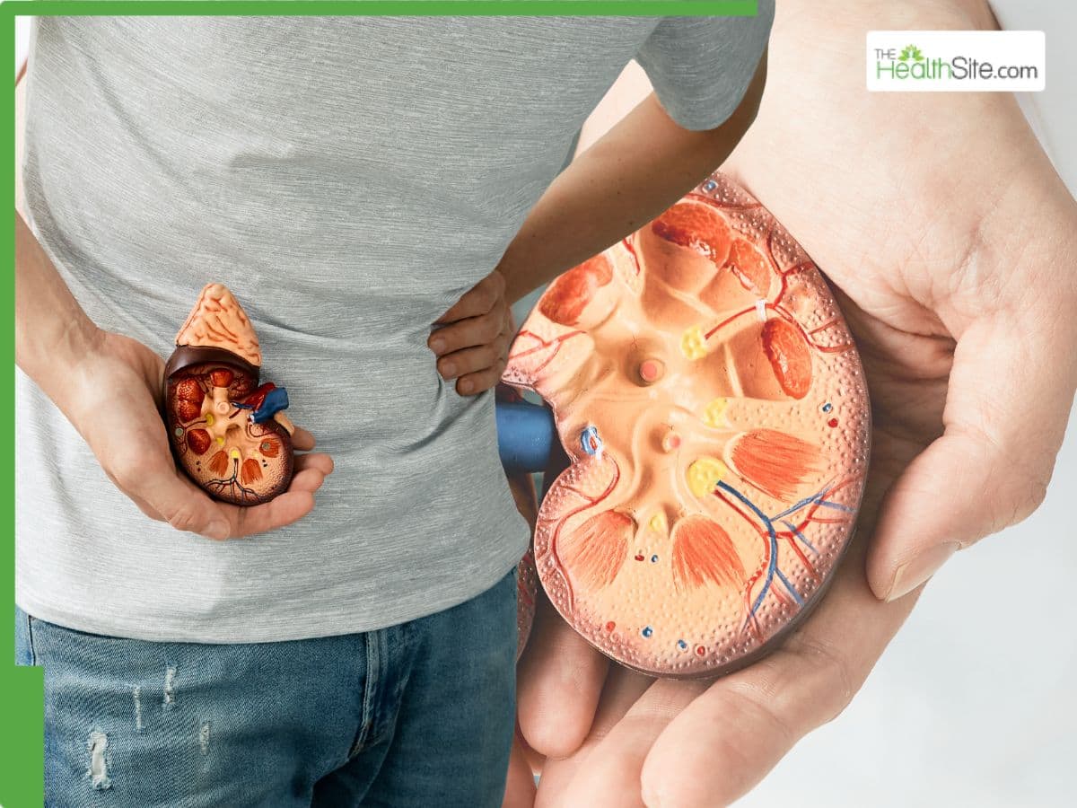 Kidney Diseases On The Rise In India: 138 Million Affected Hospitalisations Hit Alarming Levels - What's Behind The Alarming Surge?