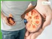 Kidney Diseases On The Rise In India: 138 Million Affected, Hospitalisations Hit Alarming Levels - What's Behind The Alarming Surge?