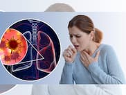 Lung Cancer Symptoms: 5 Warning Signs of a Malignant Lung Tumour You Shouldn’t Ignore