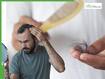 Male Alopecia Treatment: Hair Loss Is Progressive But Preventable - How To Manage Baldness Before Its Too Late
