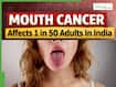 Mouth Cancer Affects 1 in 50 Adults In India: Persistent Tongue Blisters Could Be An Early Warning Sign | Expert Explains