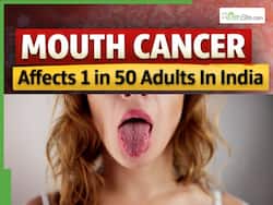 Mouth Cancer Affects 1 in 50 Adults In India: Persistent Tongue Blisters Could Be an Early Warning Sign | Oncologist Explains