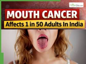 Mouth Cancer Affects 1 in 50 Adults In India: Persistent Tongue Blisters Could Be an Early Warning Sign | Oncologist Explains Mouth Cancer Affects 1 in 50 Adults In India: Persistent Tongue Blisters Could Be an Early Warning Sign | Oncologist Explains