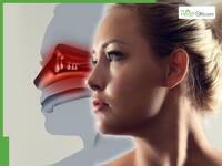 Stuffy Nose? 6 Habits To Avoid If You Have Nasal Polyps