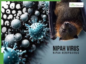 Nipah Virus Outbreak 2026: Deadly Bat-Borne Virus Can Cause Permanent Brain Damage, Coma, Cardiac Arrest - Expert Warns