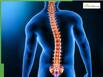 Scoliosis Is Not Just Bad Posture: Doctor Explains Types, Risks And Treatment Options