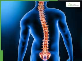 Scoliosis Is Not Just Bad Posture: Doctor Explains Types, Risks And Treatment Options Scoliosis Is Not Just Bad Posture: Doctor Explains Types, Risks And Treatment Options