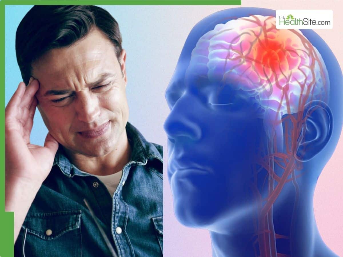 Sudden Numbness Can Be A Sign Of Brain Aneurysm: Here’s What You Need To Know