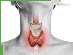 Thyroid Diet 2026: 7 Foods To Avoid If You're Diagnosed With Hypothyroidism