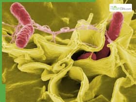 From Diarrhoea To Bloodstream Infection: Typhoid Symptoms You Shouldn   t Ignore As The Life-Threatening Infection Spikes In India