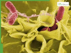From Diarrhoea To Bloodstream Infection: Typhoid Symptoms You Shouldn   t Ignore As The Life-Threatening Infection Spikes In India