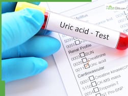 5 Winter Foods That Can Worsen Uric Acid Levels