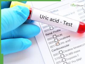 5 Winter Foods That Can Worsen Uric Acid Levels