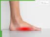 Flatfeet Exercises: 5 Simple Tricks For Quick Pain Relief