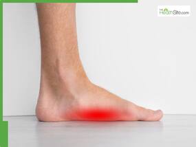 What Is Flat Feet Pain? 5 Simple Exercises For Quick Relief