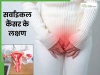 भारत में हर 8 मिनट में एक महिला की सर्वाइकल कैंसर से मौत, जानें क्या हैं इस बीमारी के लक्षण