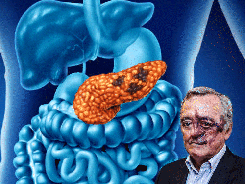 Pancreatic Cancer Cure: Spanish Scientists Cure Pancreatic Cancer In Mice Without Major Side Effects | Key Findings