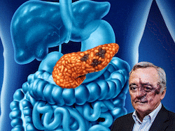 Pancreatic Cancer Cure: Scientists Cure Pancreatic Cancer In Mice Without Major Side Effects | Key Findings