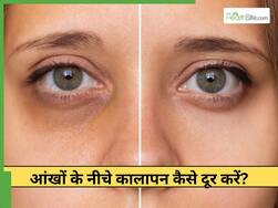 रातभर आंखों पर लगाकर रखें ये 1 चीज, डार्क सर्कल्स को दूर करने में है फायदेमंद