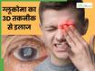 ग्लूकोमा का 3D तकनीक से इलाज, इस हॉस्पिटल के डॉक्टरों ने किया कमाल, जानें क्या है आंखों की यह बीमारी?
