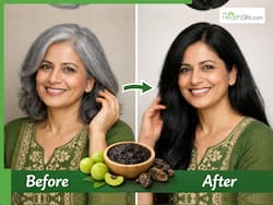 सूखे आंवला से कैसे सफेद बाल होने लगेंगे काले? इस्तेमाल का तरीके भी बेहद आसान